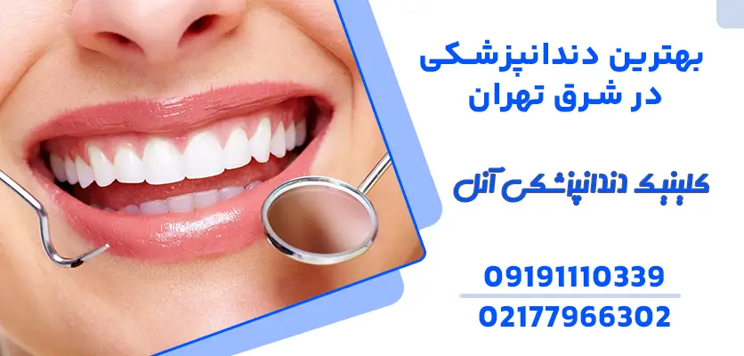 بهترین دندانپزشکی شرق تهران و 10روش جلوگیری از پوسیدگی دندان