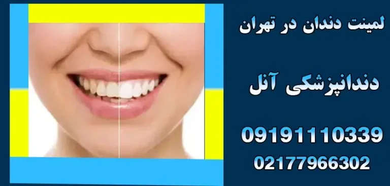 درمان زبان سفید و بوی دهان