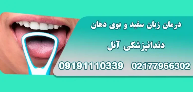 بهترین مسواک برقی برای دندان ها