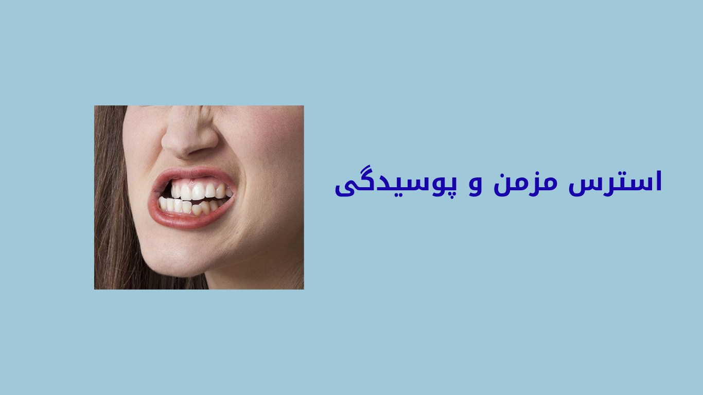 تأثیر اضطراب بر دندان