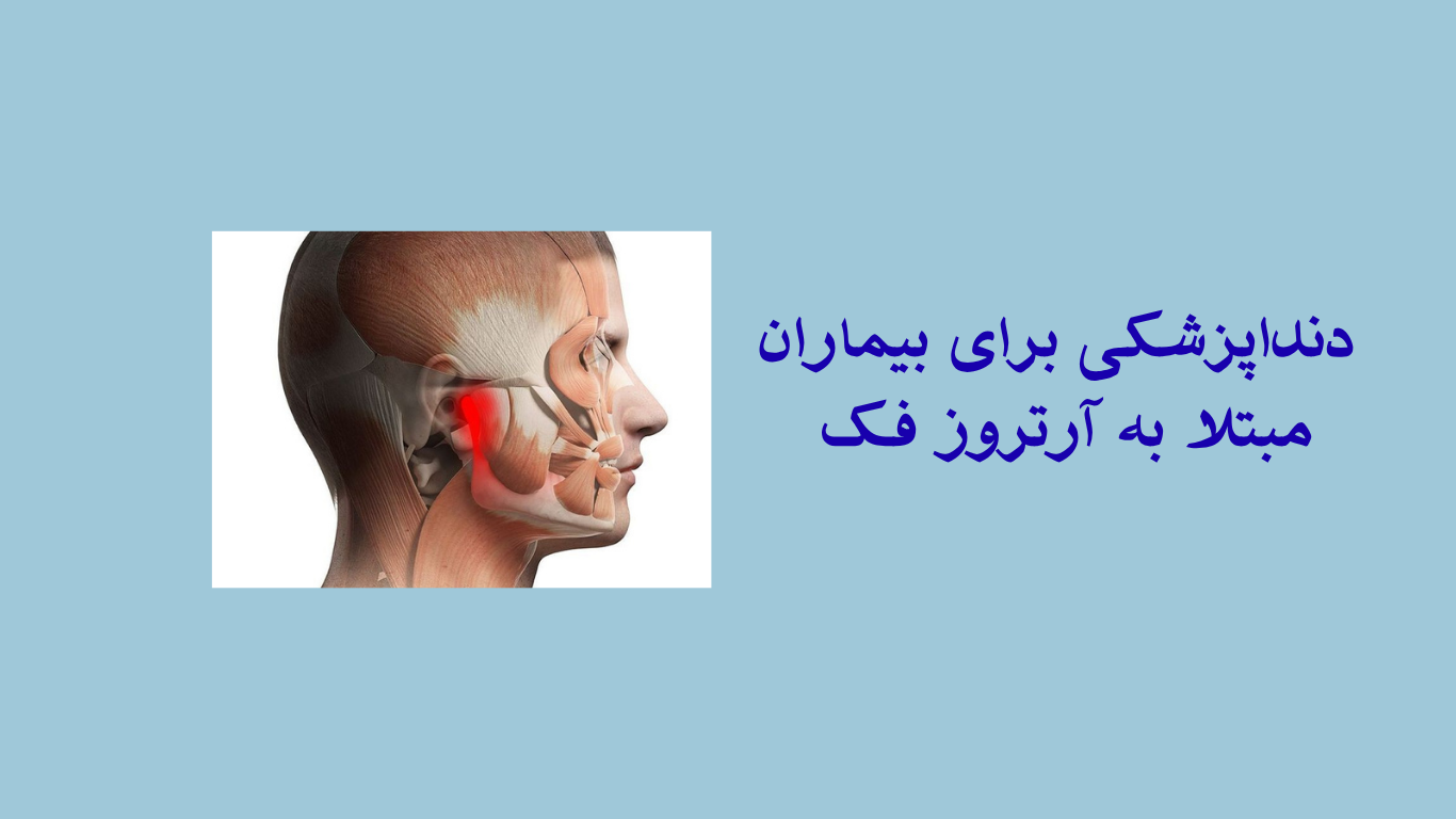 درمان دندان با آرتروز فک:آرتروز مفصل فک و راهکار های آن